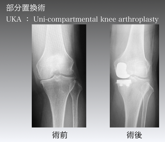 症状／疾患別 中医正骨・推拿－写真でみる準備手技と治療実技